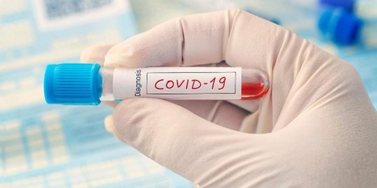 Unair Klaim Temukan Obat Covid-19, DPR: Semoga Akhiri Kekhawatiran Masyarakat